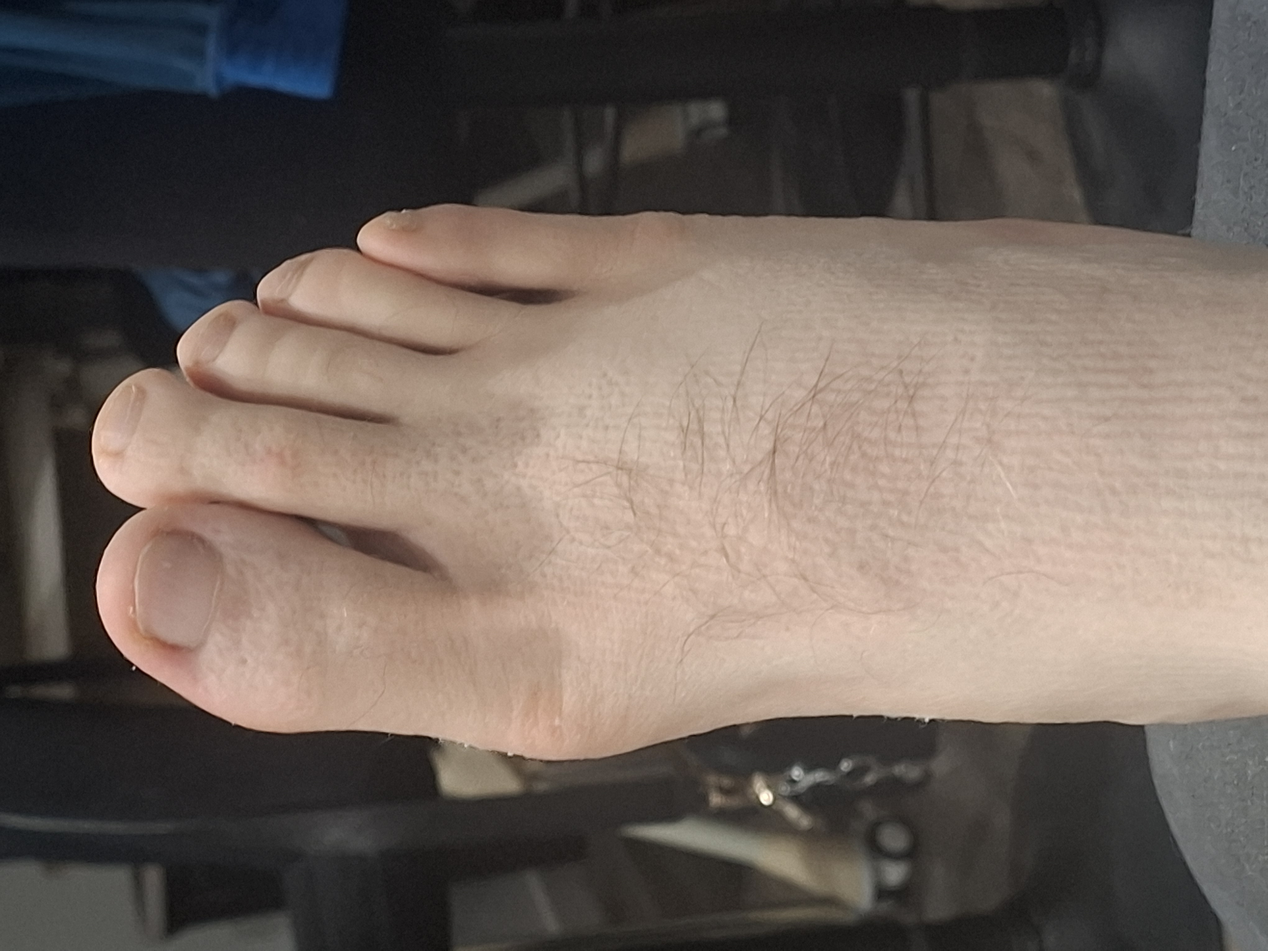 Momofeet