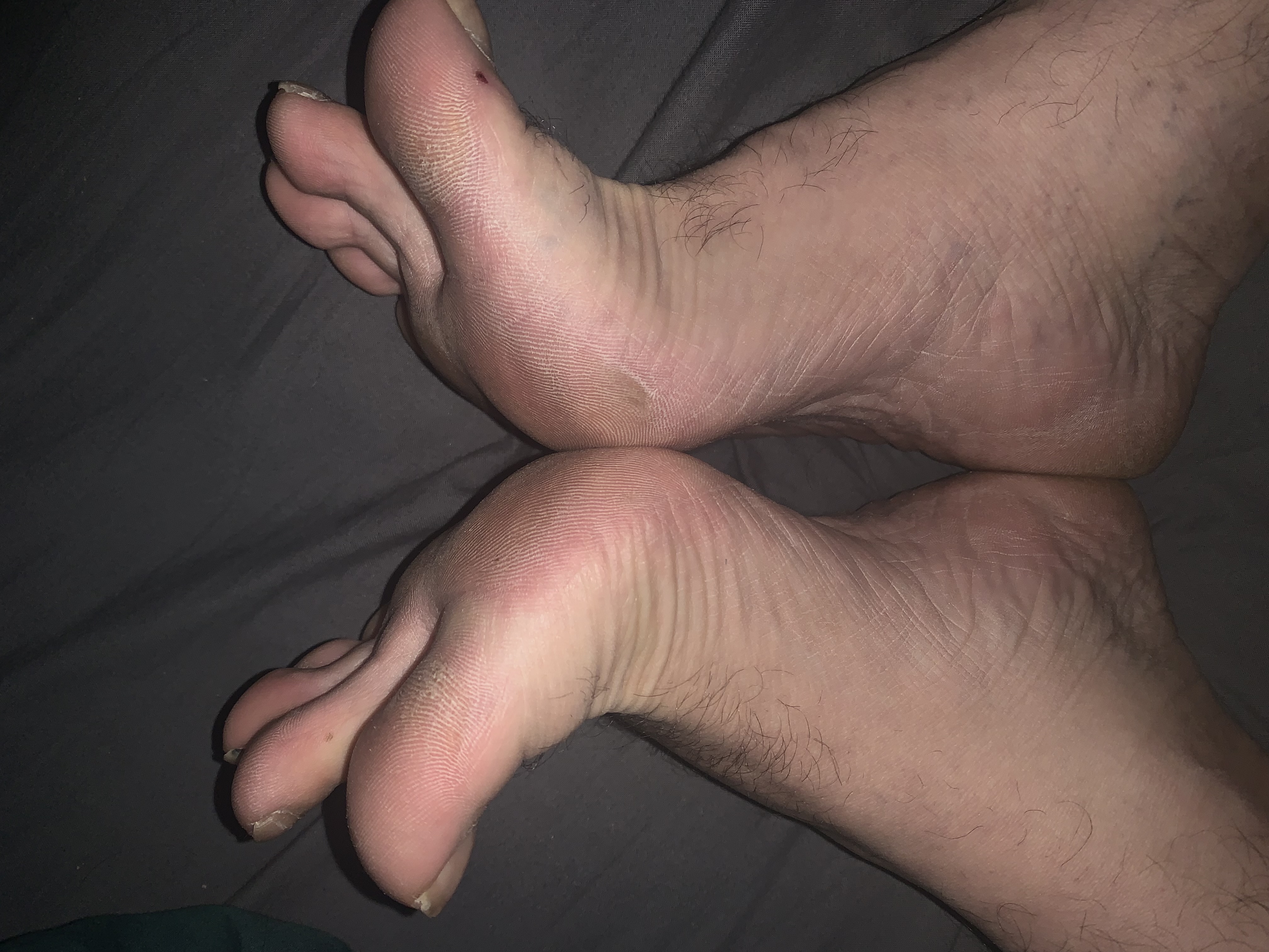 Foryou