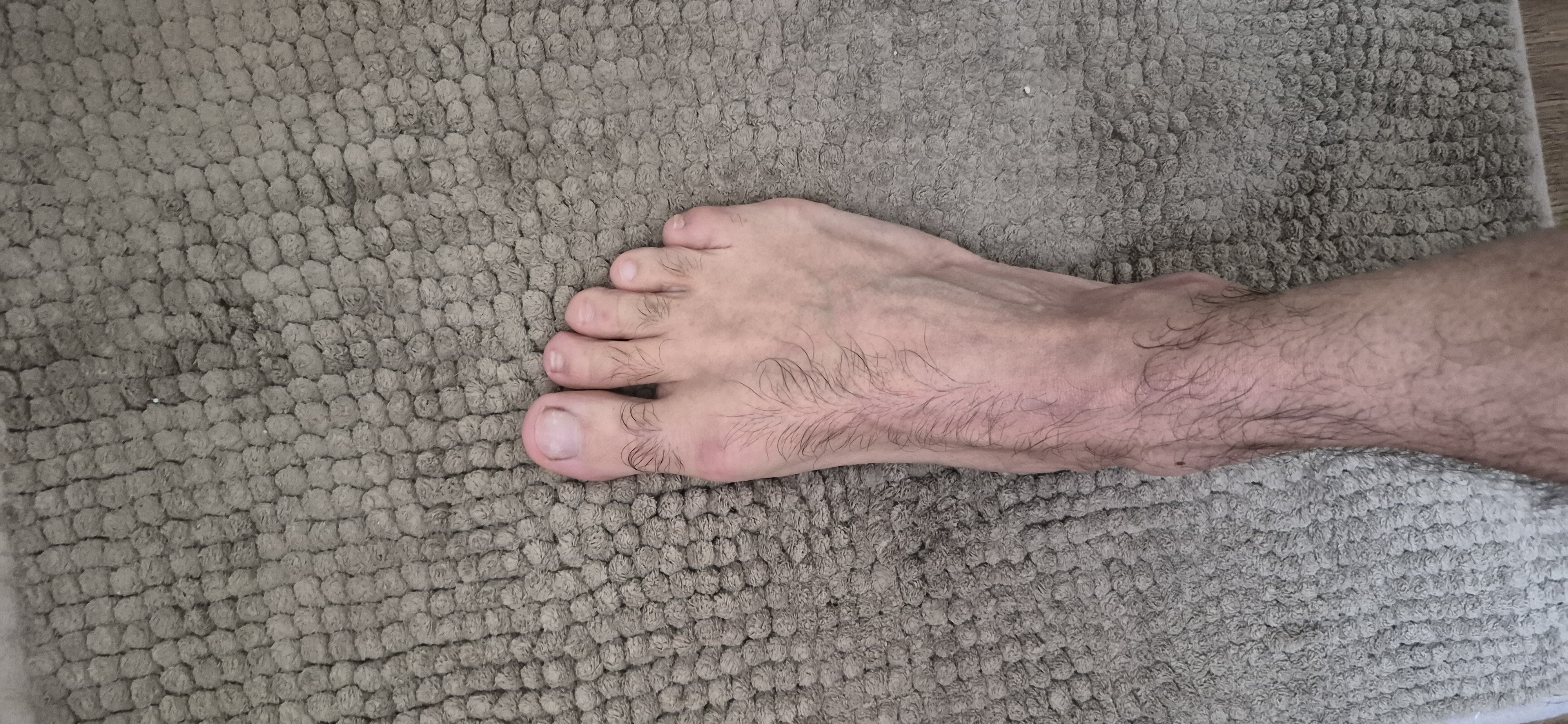 Photo de Bipied